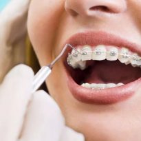 Why More Dentists Are Enrolling In Orthodontic Courses
