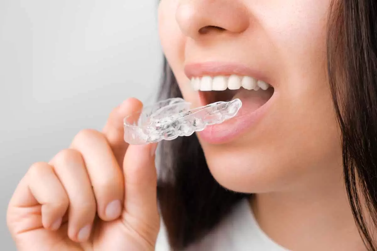 Orthodontics Stock Photo 03